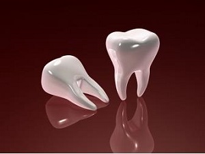 Dental Implants Arizona